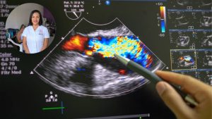 Vecinos reciben Ecografía Doppler gratuita en Playa del Carmen como parte de la campaña de salud del Club de Leones y EME.