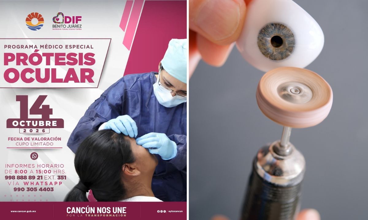 Prótesis oculares gratuitas en Cancún